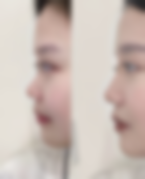 郑盛宇医生简介之做手术价格