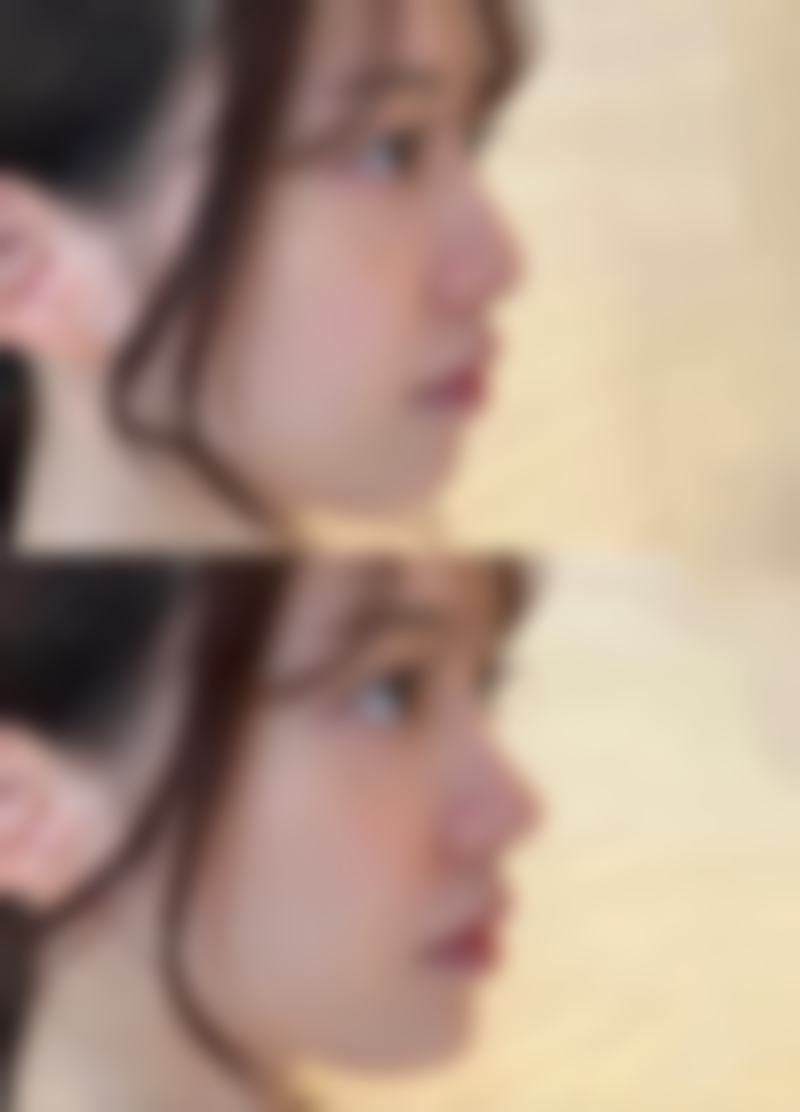 绍兴歆菲医疗美容抖音团购活动有哪些,价格表