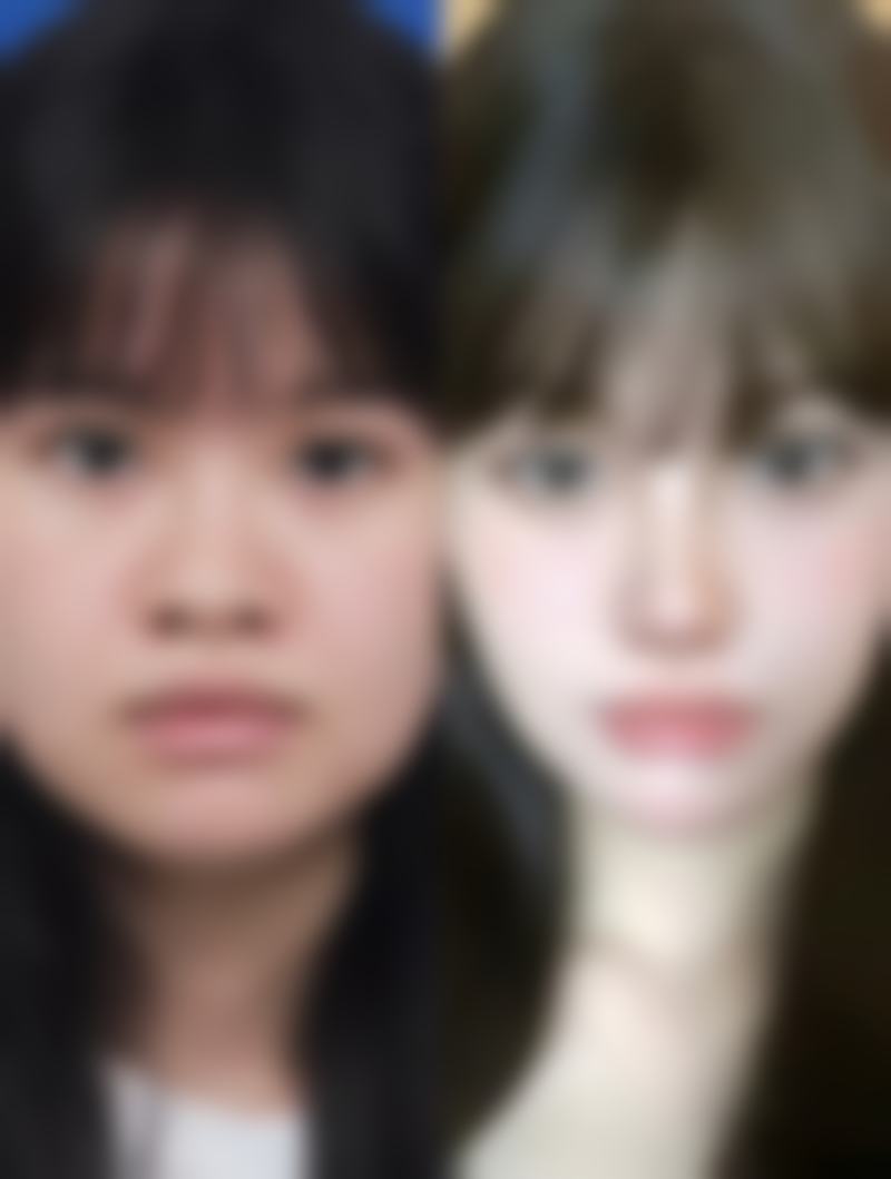 安徽宿州惠尔美医疗整形美容口碑好不好