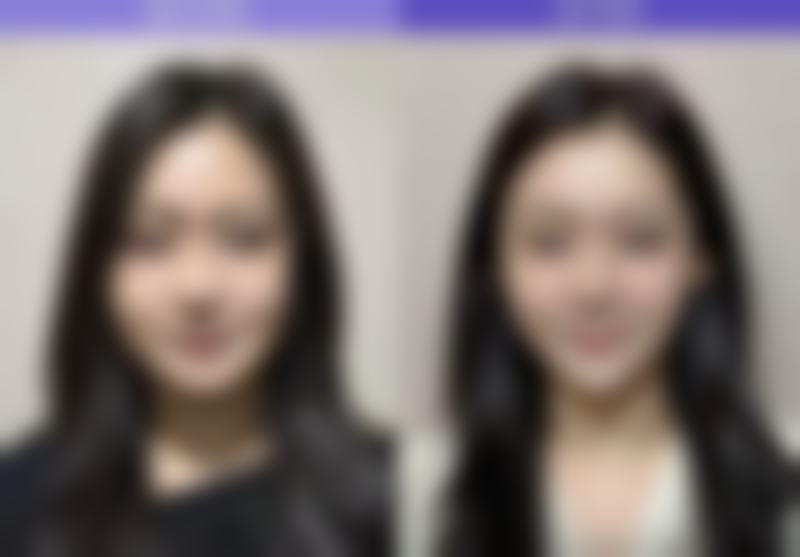 李秋涛医生做手术价格