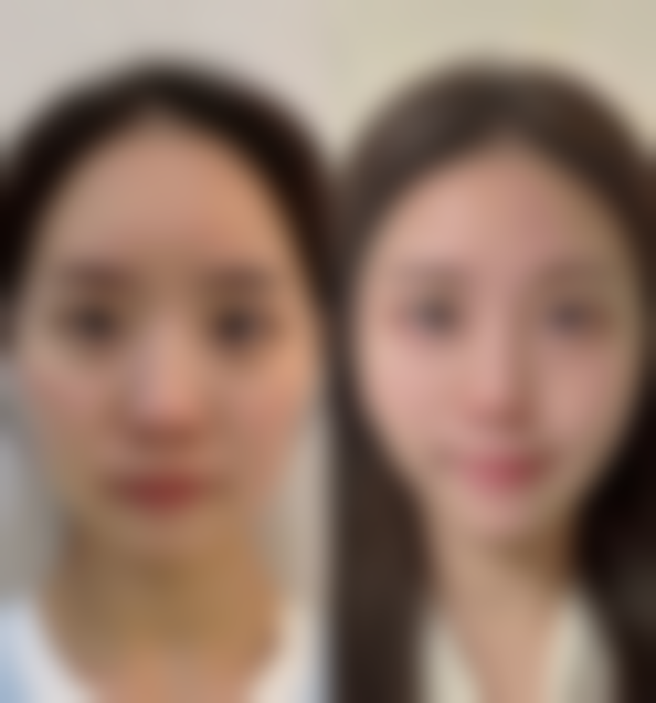 胡瑞芬医生顾客实例图片