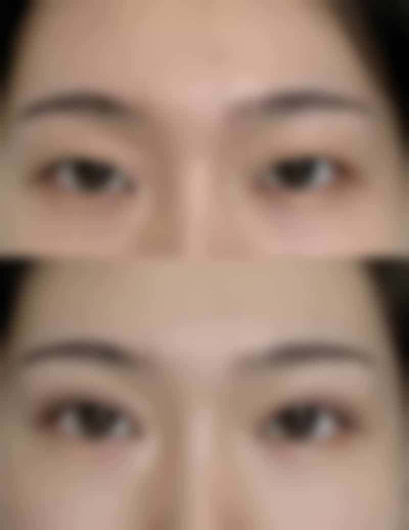 南通英莎医疗美容门诊部李辉做过的真实反馈——大麦医疗美容诊所