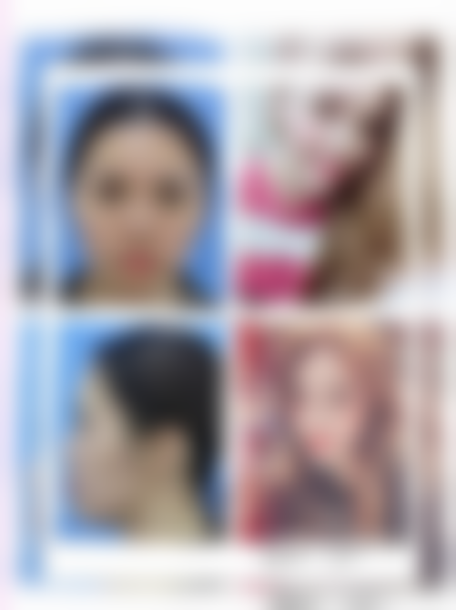 王嵘医生简介做手术价格