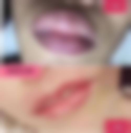 多年陈旧烫伤疤痕:医院提供的有效解决方案