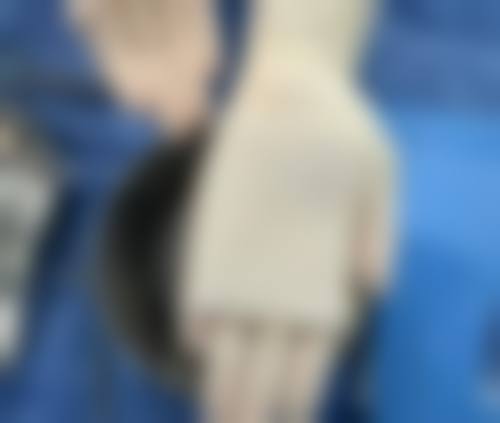 膨体隆鼻之后可以捏吗?按压时间与注意要点讲解