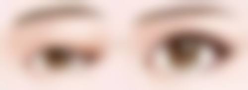 开水烫伤疤痕如何消除？医生推荐医用凝胶+防晒护理，儿童多年疤痕也能修复