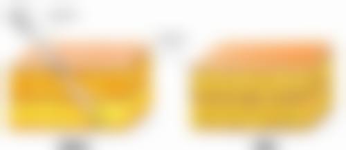 隆鼻后护理的终极建议:科学护理成就理想鼻型