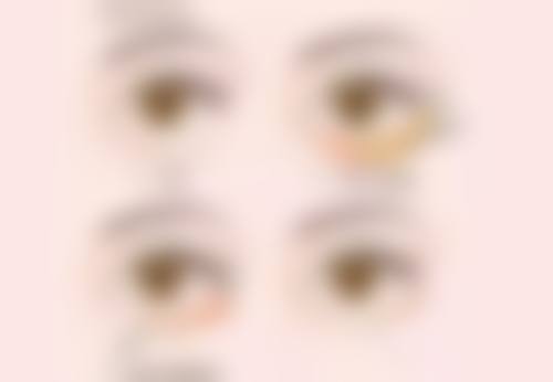 余琦医生怎么挂号