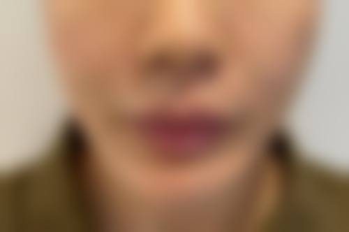 武汉艾美整形医院项目特色