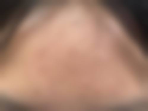 四、大庆油田总医院整形美容科怎么样——项目特色