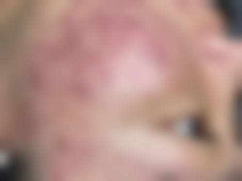 崔奎振医生简介做手术价格