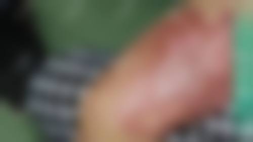 韩国半岛眼整容外科（BIO整形外科）医院怎么样，口碑评价如何？