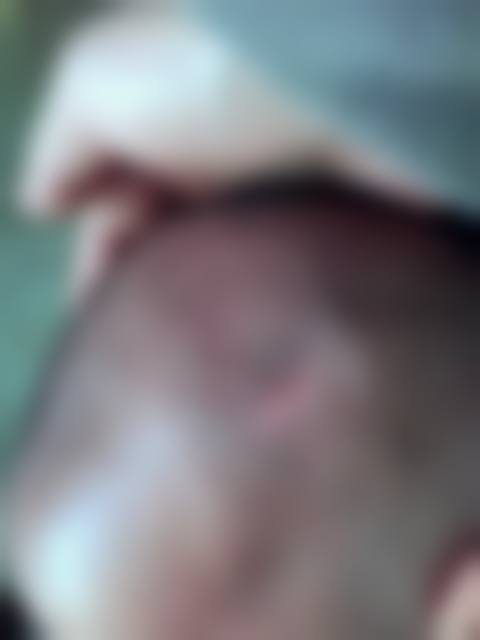 谈君林医生项目优势