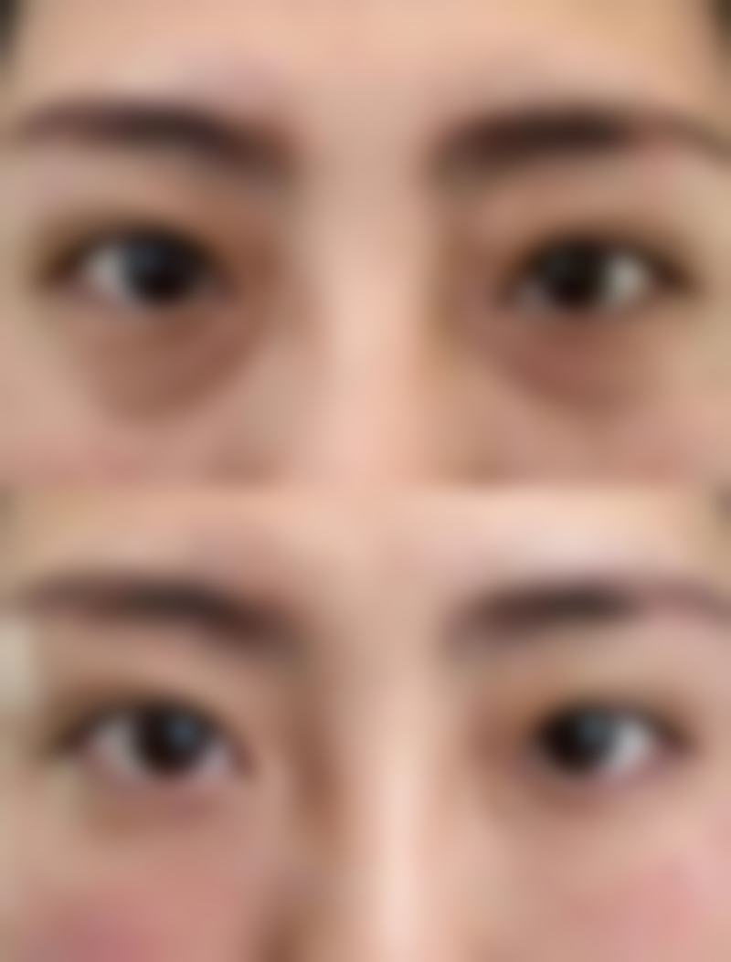 疤痕疙瘩怎么治疗能去根:中医疗疗的特色与融合