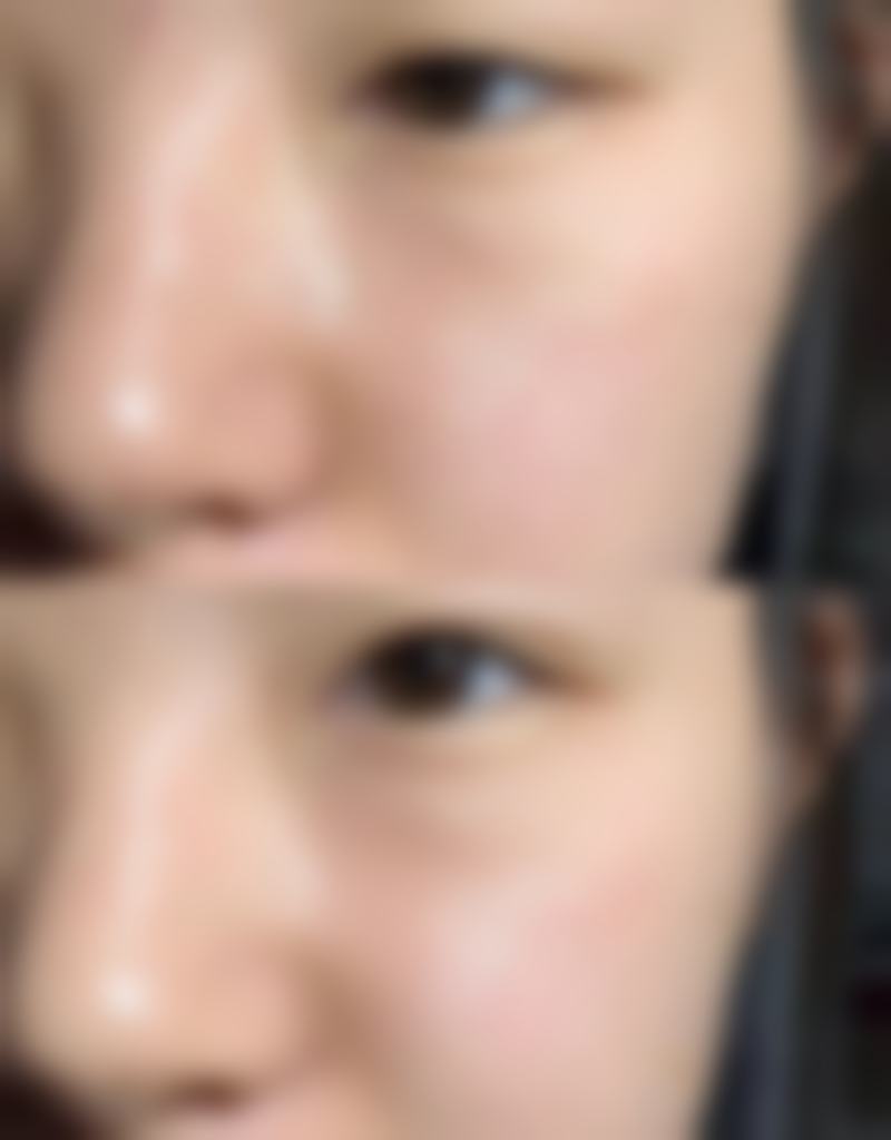 金尧汉医生做手术价格