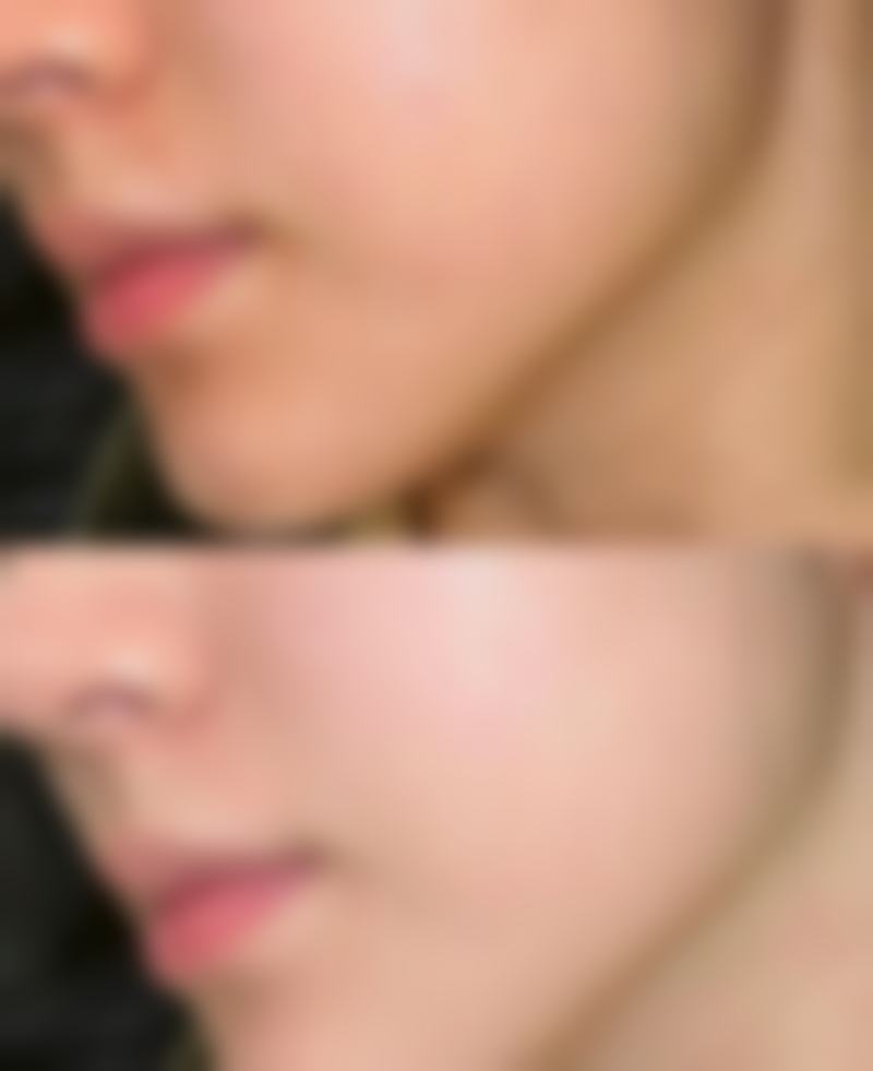 郑光锡医生简介做手术价格