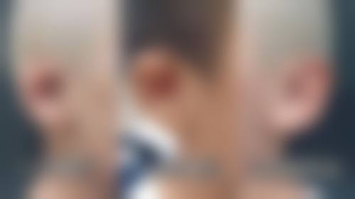 程亚萍医生项目优势