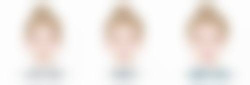 疤痕增生变软是好的征兆吗？消退期变软速度与恢复情况揭秘