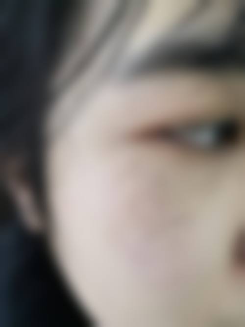 陈秀华医生简介项目优势