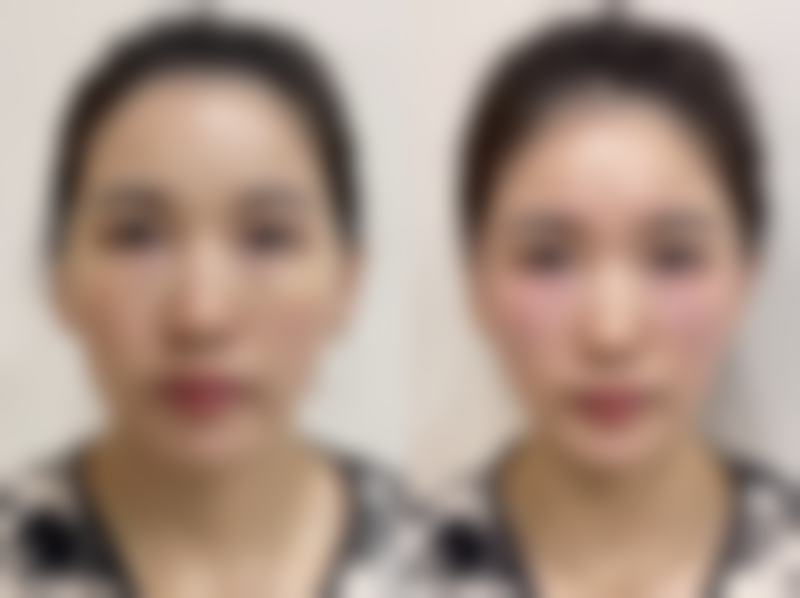 郭丽娟医生简介之项目优势