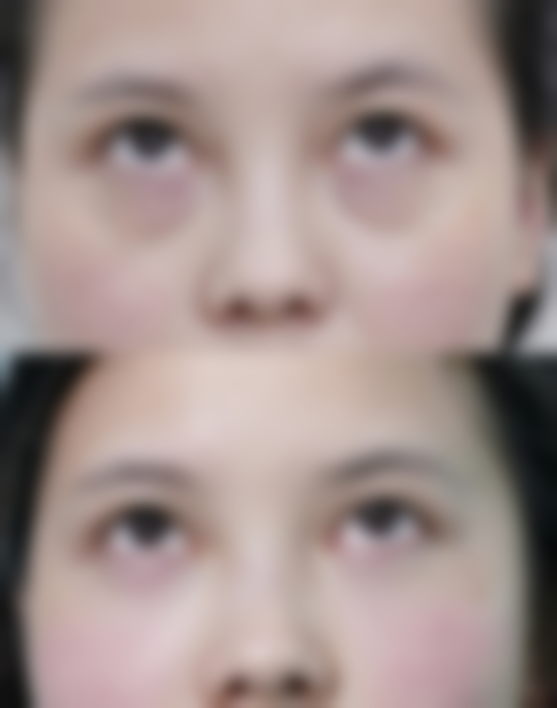 上海微蓝整形医院价格表