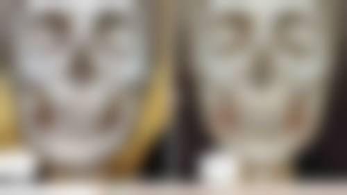 什么牌子瘦脸针最好？保妥适vs衡力大比拼，安全效果全解析