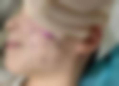 长沙芙蓉美德思医疗美容门诊部顾客实例