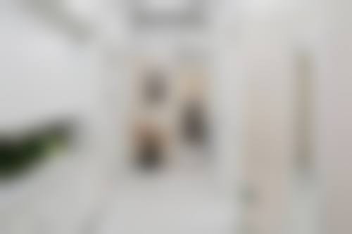 打了瘦脸针多久可以锻炼之时间节点分析