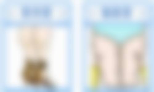 打了瘦脸针轻度锻炼可以吗之推荐与注意