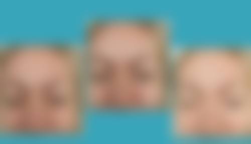 青岛瑧妍美医疗美容医院刘晨涛眼鼻综合项目联系方式及亮点