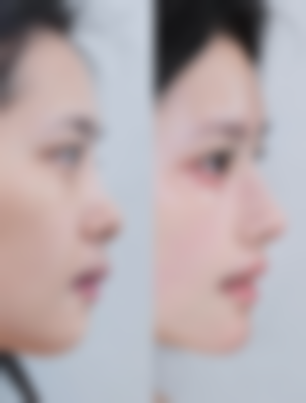 什么牌子瘦脸针更好——从正规性角度筛选