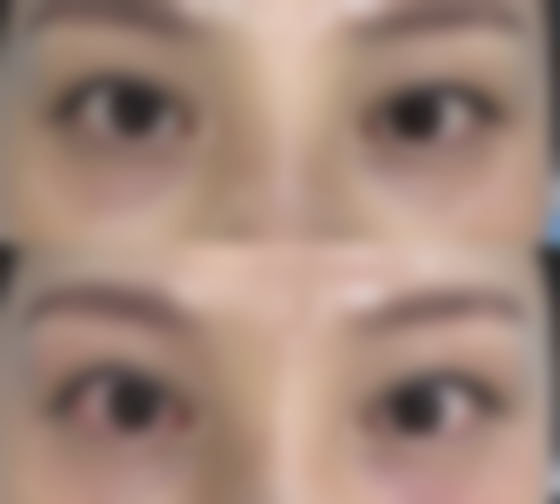 青岛瑧妍美医疗美容医院刘晨涛常见问题解答