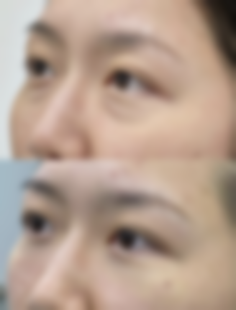 温州友好医院整形美容科价格表