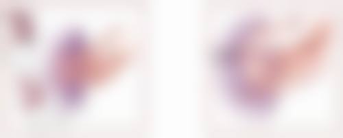 黑眼圈大眼袋怎么消除——充足睡眠保护