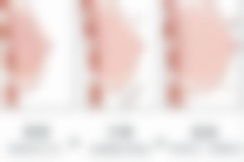 七、湖北省比较好的医美医院之医美消费指南：明智选择，避免踩坑