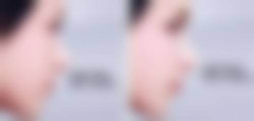 王晓平医生简介做手术价格