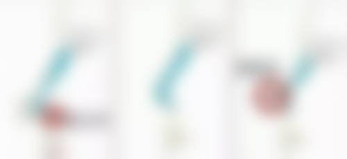 肚子吸脂感染风险大吗：警惕看不见的健康杀手