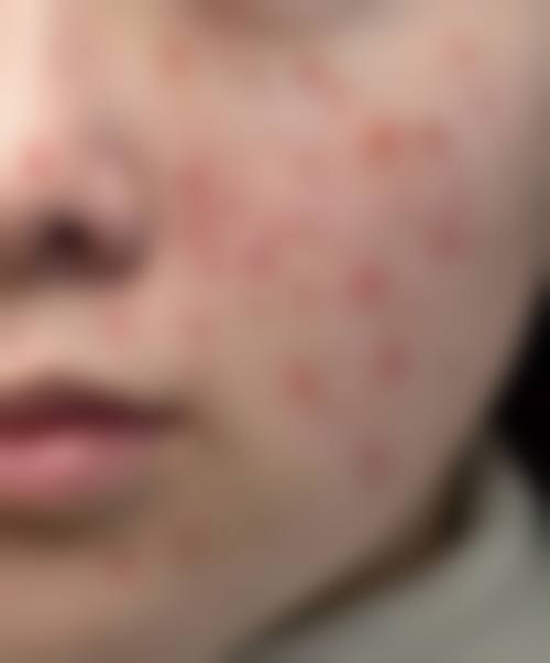 幸福缪斯微整形抖音团购活动有哪些，价格表