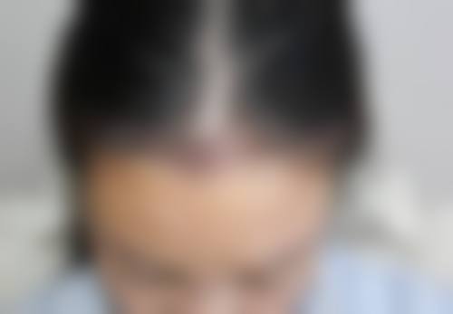 龙岩欧菲医疗美容门诊部怎么样，顾客实例