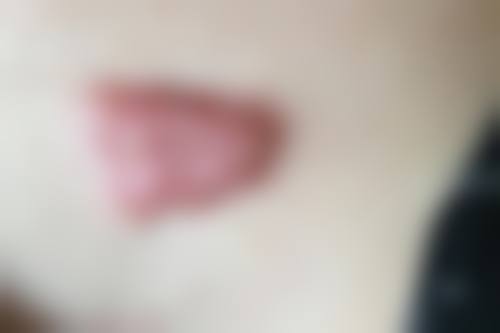 河池医莱医疗美容诊所怎么样，价格表