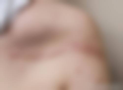 幸福缪斯微整形正规吗