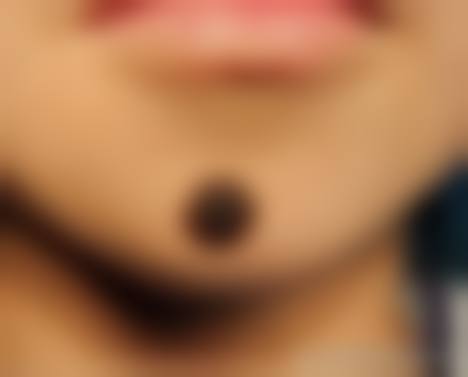 张家界华美医疗美容门诊部顾客实例多吗