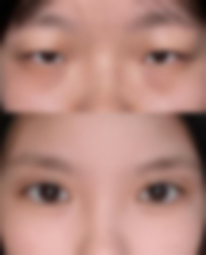 上海德琳医疗美容医院 （男性私密中 心）乐威做过的真实反馈——上海美莱医疗美容医院