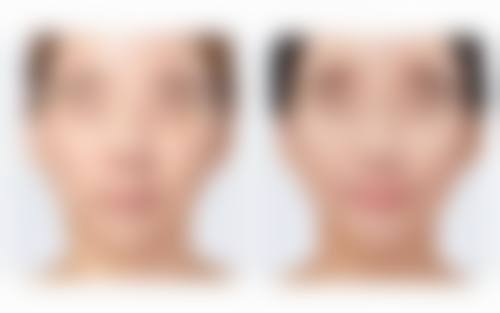 什么时候隆胸比较好——心理准备的重要性