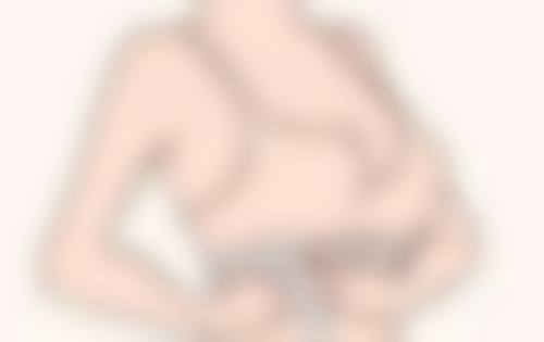 三、眼袋突然水肿的原因——过敏引发的眼部危机