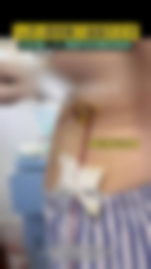 浙江绍兴上虞人民医院整形科口碑好不好?附真实患者口碑评价