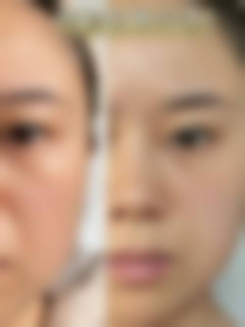 钟玉凤医生简介做手术价格