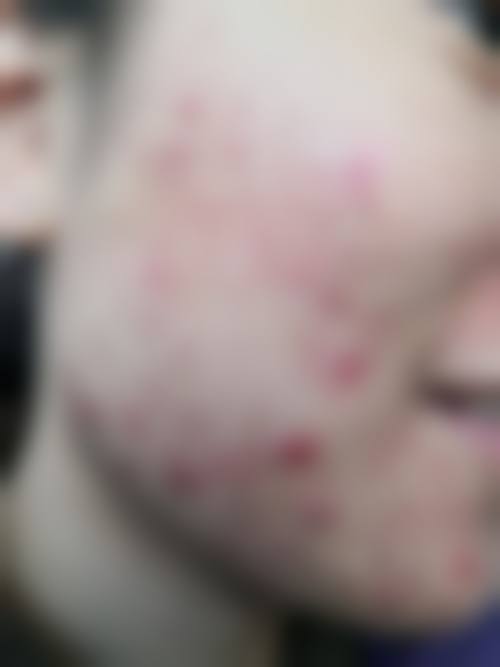 湖北省彭华伟和刘敏先技术实力比拼