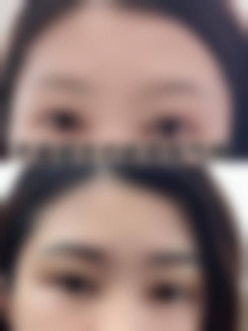 北京臻瑞汇美医疗美容门诊部顾客实例