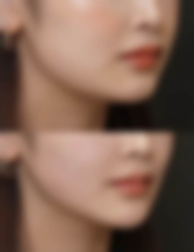 五、眼袋突然水肿的原因——眼部炎症的警报信号